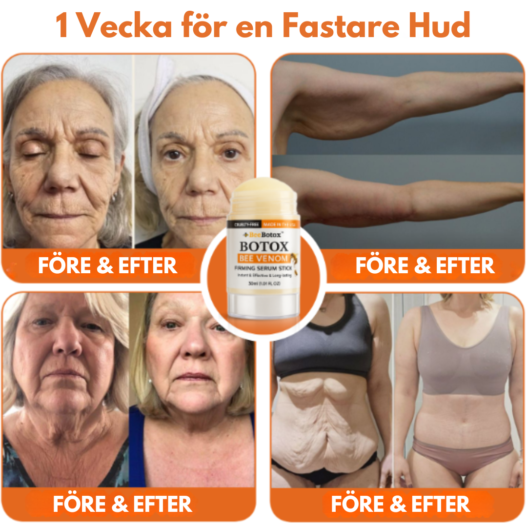 BeeBotox™ | Uppstramande stick