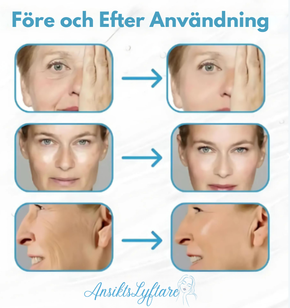 AnsiktsLyftare™ | Serum