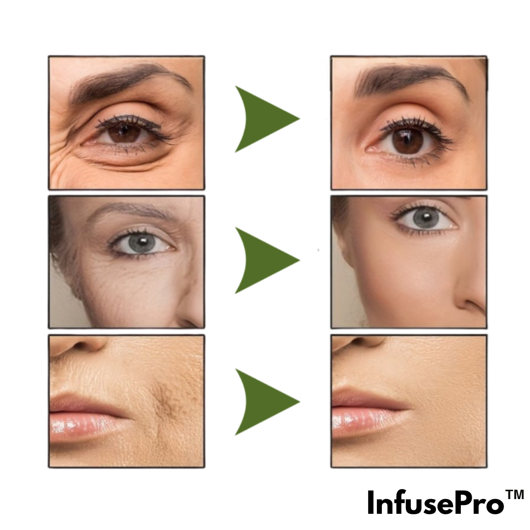 InfusePro™ | Mikro-infusionsserum